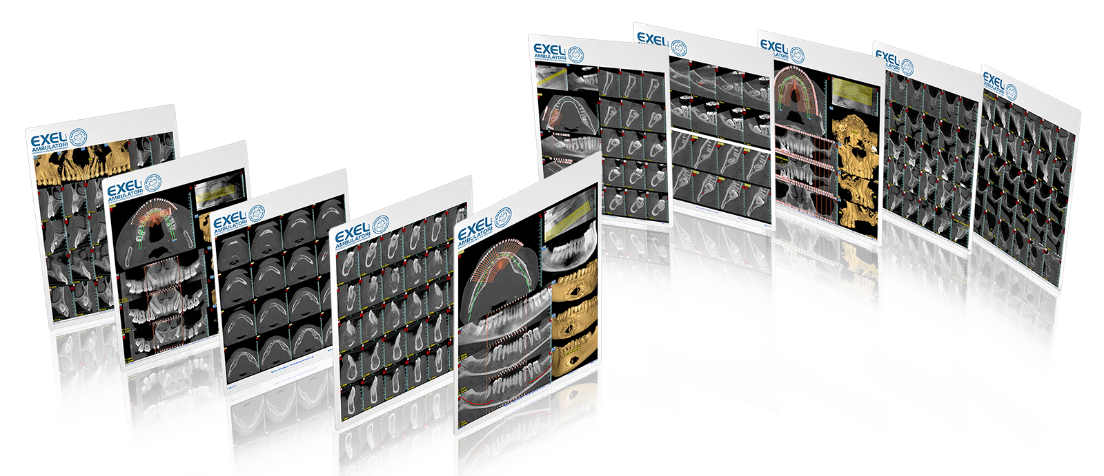 Exel Radiologia 3D Exel radiologia 3d