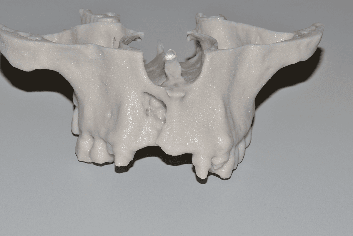 Exel Replica anatomica vista frontale Exel replica anatomica vista frontale
