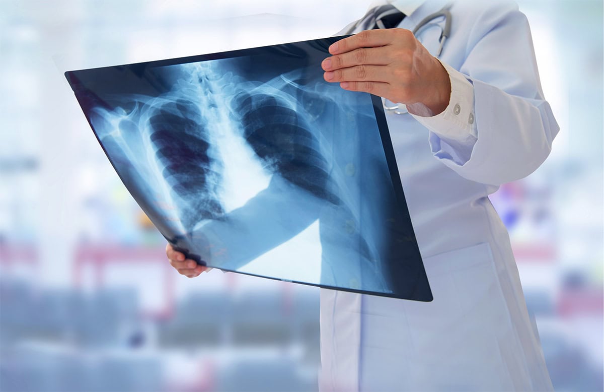 exe scheletrica radiologia scheletrica