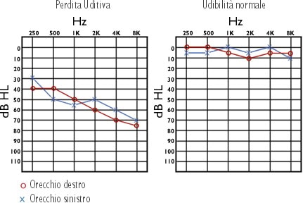 esame audiometrico grafico Esame audiometrico grafico