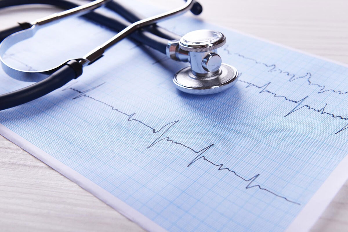 Diagnostica Elettrocardiogramma EXEL Ambulatori Diagnostica elettrocardiogramma exel ambulatori