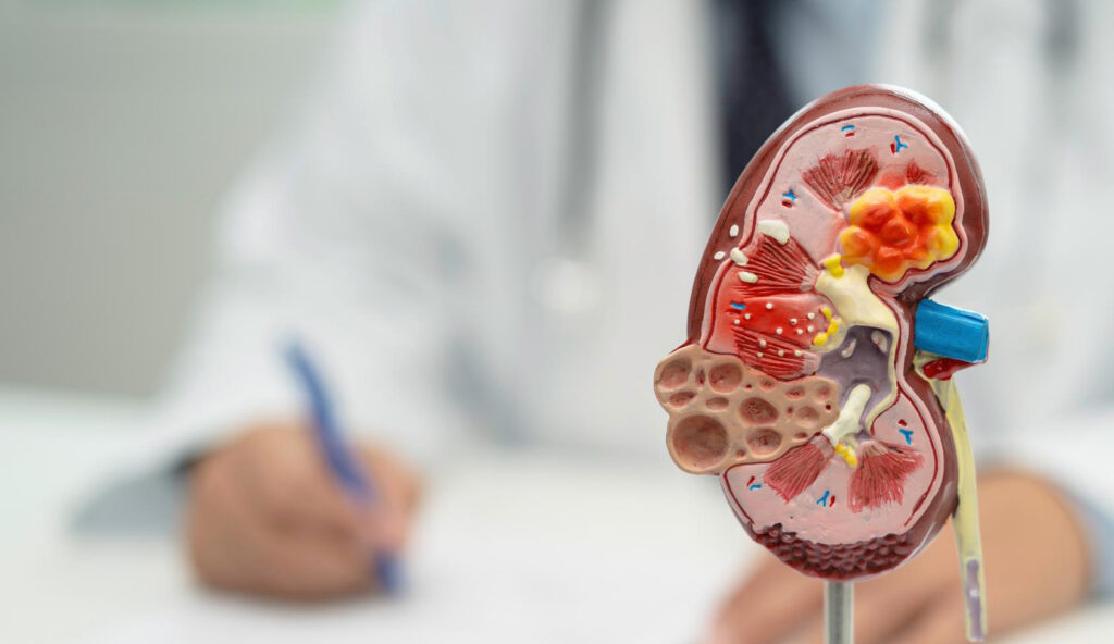 Sangue nelle urine urologia