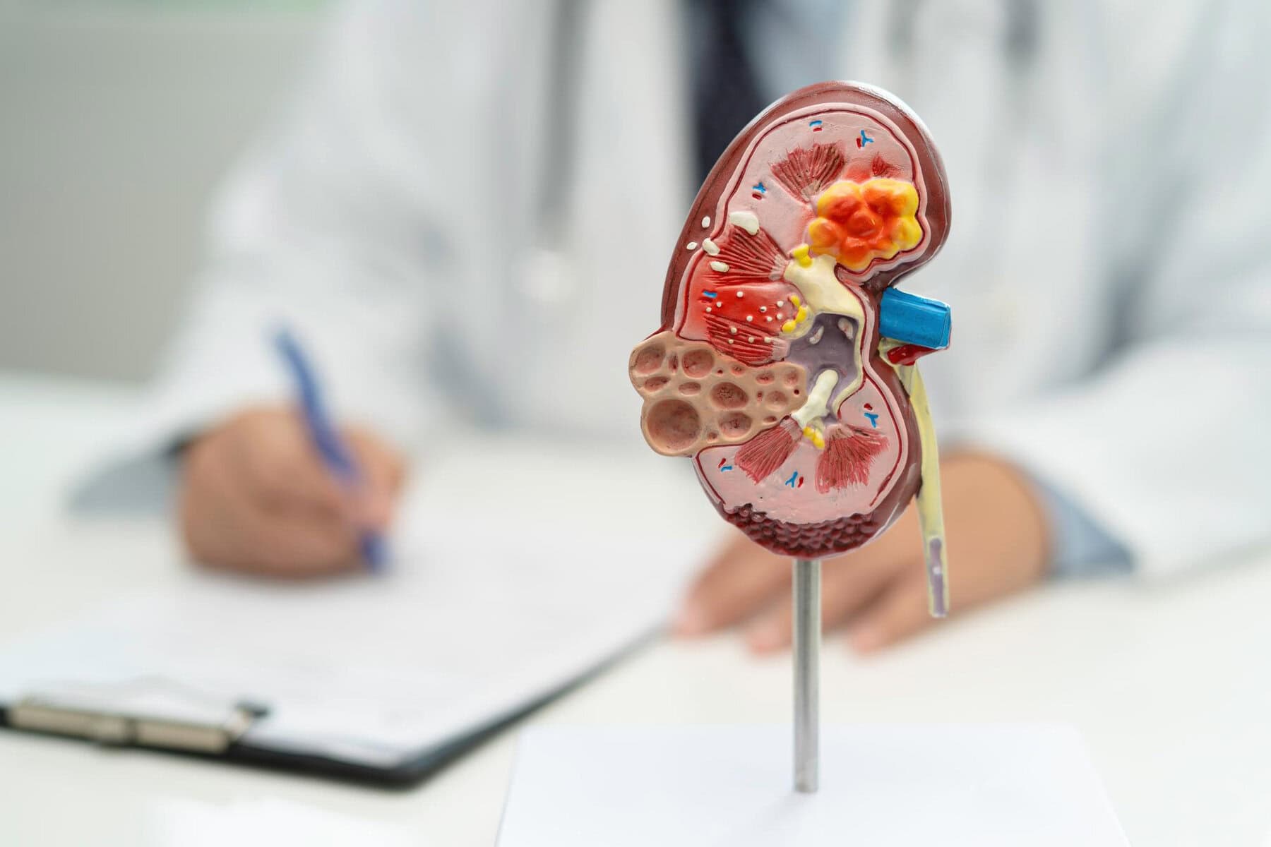 Sangue nelle urine urologia